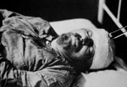 trotsky-on-deathbed.jpg