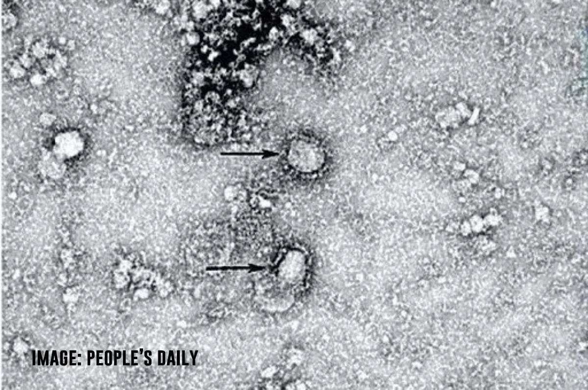Coronavirus