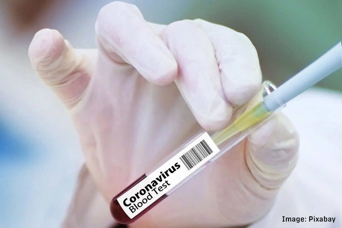 Coronavirus-test